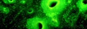 tetracycline in ancient bones